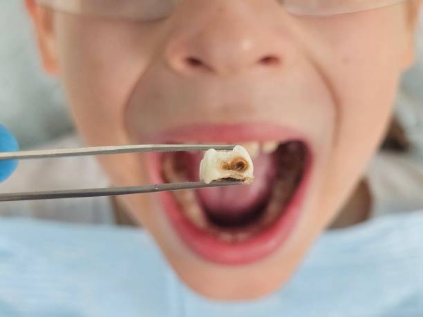 Best Weekend Emergency Dentist in Bonner Springs, KS